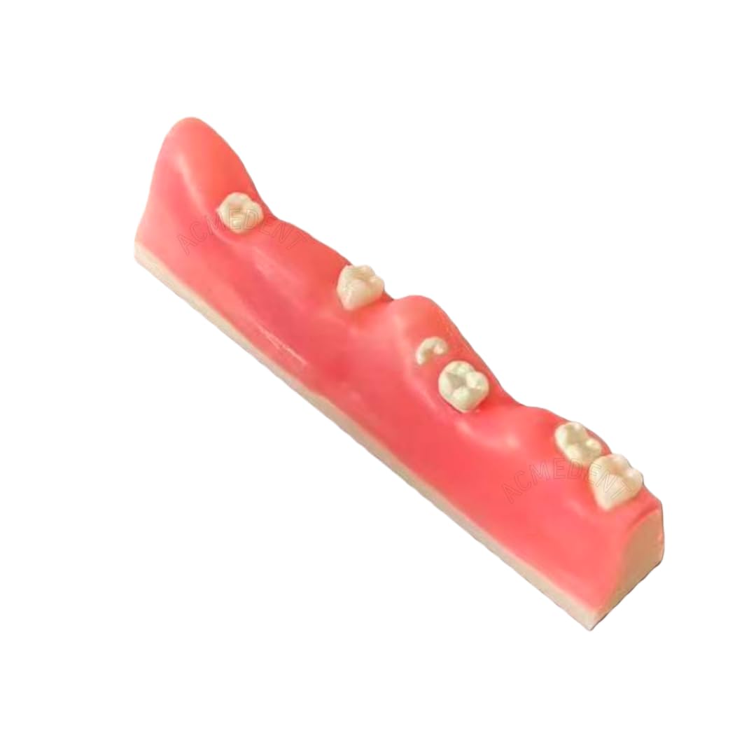 Extract Wisdom Teeth Model Dental Impacted Tooth Extraction Practice Models Training