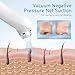 Blackhead Remover Vacuum, USB Interface Type Pore Vacuum, Black Head Extractions Tool with Camerafor, Men and Women Pore Cleaner, 3 Adjustment Modes & 6 Suction Heads(Light Pink)