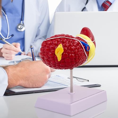 Modèle anatomique du foie pour expliquer les maladies aux patients - 3