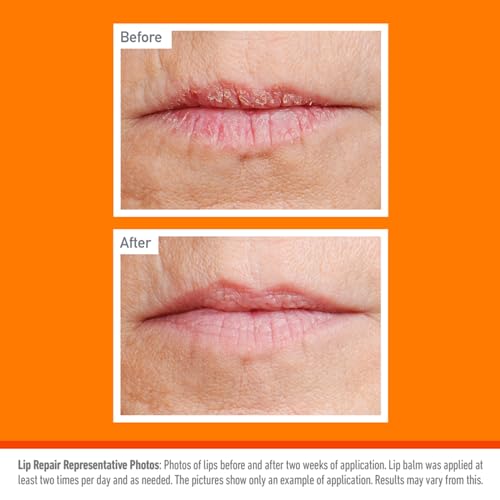 O'Keeffe's Lip Repair Cherry, 4.2g – For Extremely Dry, Cracked Lips | With Cherry & Vitamin E Oil, Provides All Day Hydration - Image 6