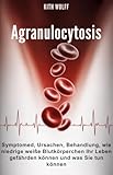 Agranulocytosis : Symptome, Ursachen, Behandlung, wie niedrige weiße Blutkörperchen Ihr Leben gefährden können und was Sie tun können