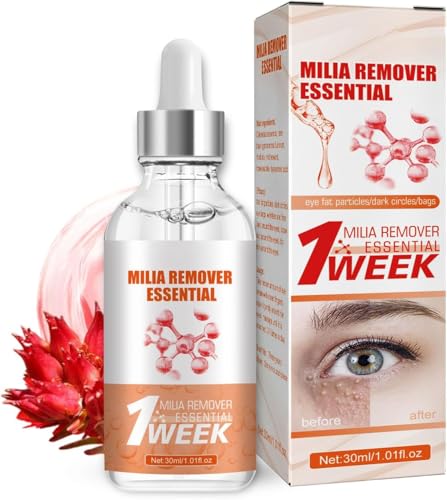 Milia Sérum démaquillant pour le contour des yeux – Sérum facial contre les miliums et les taches brunes, pour homme et femme, réduit le relâchement de la peau, les gonflements et les ridules, 30 ml