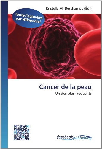 Cancer de la peau: Un des plus fréquents