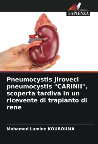 Pneumocystis Jiroveci pneumocystis 'CARINII', scoperta tardiva in un ricevente di trapianto di rene