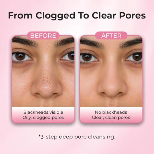 Image of Sanfe Aloe Vera 3 Step Nose Kit | 3 Units | Nose Strips for Blackhead Removal Routine | Deep Cleansing Pore Cleaning Strips for Oily Skin Care | At Home Cleansing Kit | Peel-Off Mask Style (Pack of 2)