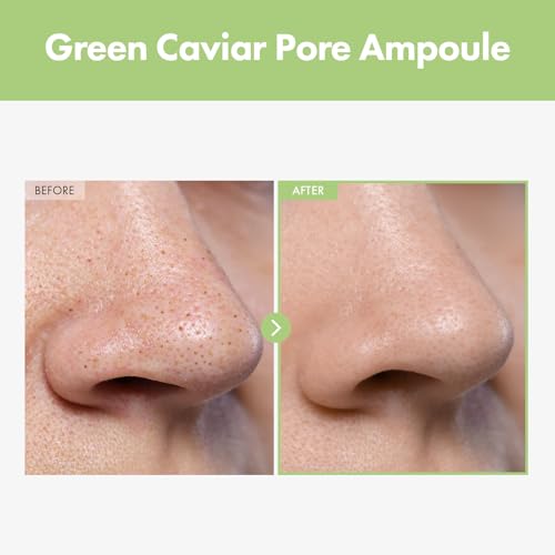 Image of TOSOWOONG Green Caviar Pore Ampoule for Pore Care, Firming, Hydrating