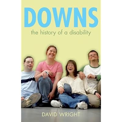 Downs