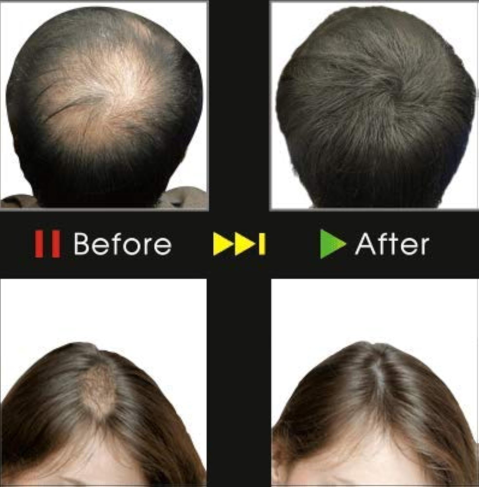 Vanquish Men Hair Building with Natural Cotton Fiber