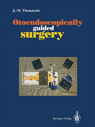 Otoendoscopically Guided Surgery view 2