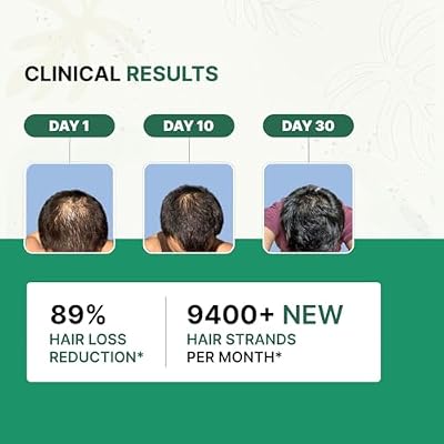 Rosemary Advanced Hair Growth Serum | 3% Redensyl, 4% Anagain, 3% Baicapil, 1% Capilia Longa, Rosemary, Biotin & Rice Water | Controls Hair Fall & Supports Hair Density | for Women & Men | 50ml