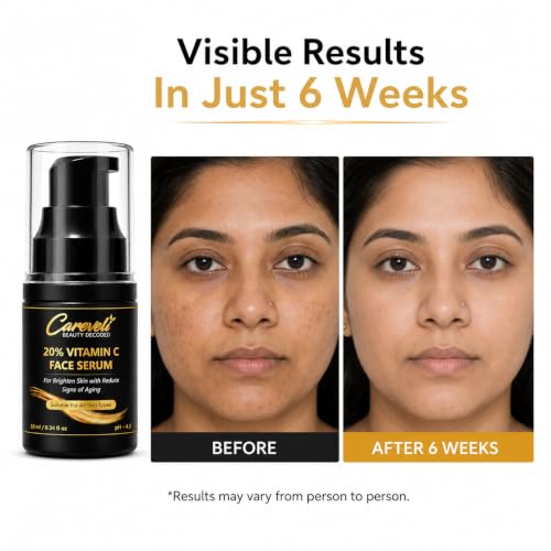 Image of 20% Vitamin C Face Serum with 5% Niacinamide, 1% Hyaluronic Acid, 0.5% Ferulic Acid & 0.1% Vitamin E | Advanced Brightening Serum for Glowing Skin, Dark Spots Appearance, Uneven Tone, Fine Lines & Radiance | 10 ml