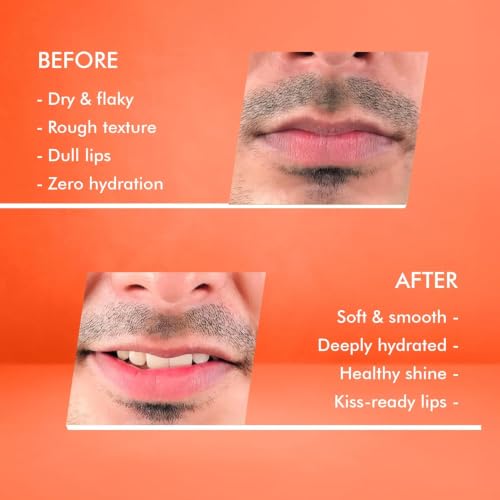 Image of 100% Natural Lip Balm for Men 10 gms (Pack of 2) | Repairs Dry & Chapped Lips | Gives Even Toned Lips | No Artificial Fragrance | Deep Hydration | For All Kinds of Weather | For Daily Use