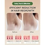 XSOUL At-Home IPL Hair Removal for Women and Men Permanent Hair Removal 999,999 Flashes Painless Hair Remover on Armpits Back Legs Arms Face Bikini Line, Corded - Image 5