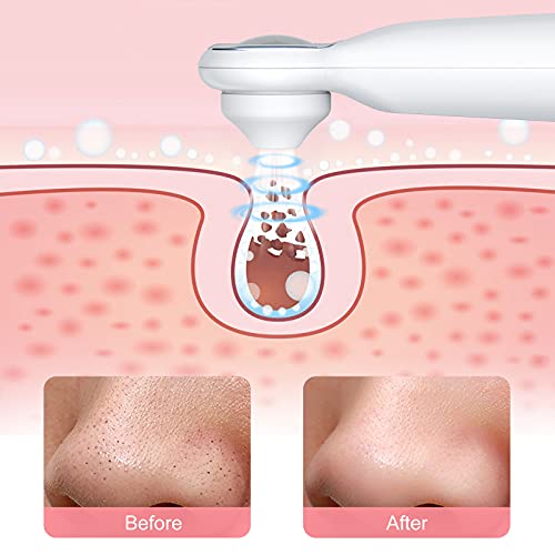 Maxcio Limpiador Facial, Limpiador de Poros, Succionador de Puntos Negros, Belleza Mujer, Quita Puntos Negros Acné… - Imagen 3