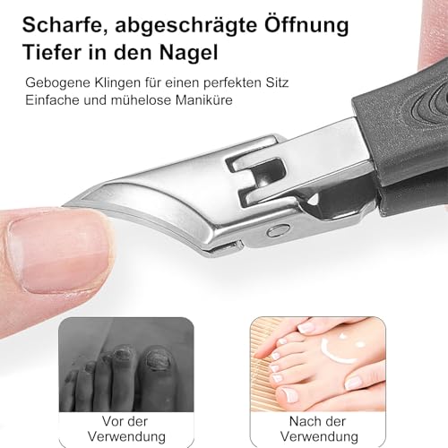DAILIENFUS 3-teiliges Set Nagelknipser mit Adler-Schnabel-Winkel für Eingewachsene Zehennägel, Nagelknipser Groß mit Auffangbehälter – Fußnägel Knipser für Senioren und Kinder.(schwarz)