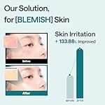 Mediheal Madecassoside Essential Sheet Mask Blemish Repair 10 pcs. 98% Purity Madecassoside & Hyaluronic Acid Included. Enhancing Moisture Barrier & Skin Texture Care. Vegan Formula Sheet Mask - Image 4