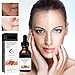 Melanin Correcting Facial Serum, Dark Spot Correcting Glow Serum, Mild and Not Stimulating for Any Part (2pcs)