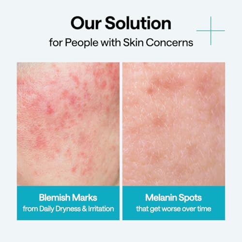 Image of MEDIHEAL Wrapping Serum Mask [Madecassoside] Blemish Repair - Intensive Calming & Repair Care with 98% Pure Madecassoside & CICA Complex - Helps Calm Skin's Blemish Spots (10 Sheets)