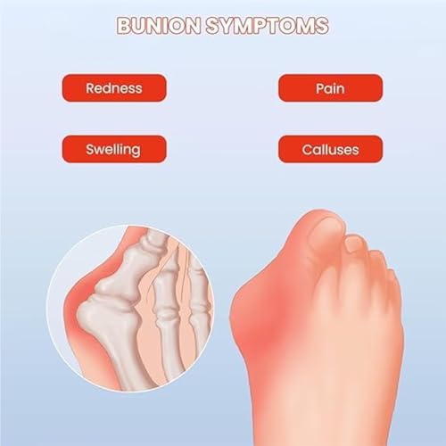 Yytcsjz Womens Bunions Orthopedic Sandal, Sandals With Arch Support Flip Flops, Wedge Heels4