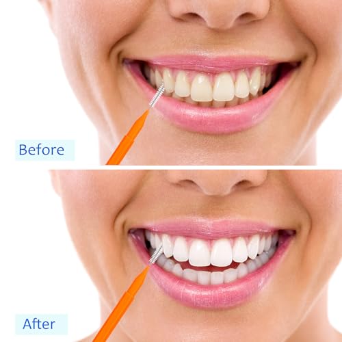 Image of Patelai 100 Pieces Braces Dental Brush for Cleaner Interdental Toothpick Dental Tooth Flossing Head Oral Hygiene Flosser Toothpick Cleaners Tooth Tool(White, Orange, Blue,Proper Size)