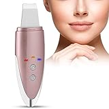 TIEFENREINIGENDE GESICHTSBEHANDLUNG - Durch hochfrequente Vibrationen kann der Gesichtshautwäscher Mitesser, Whiteheads, Keratin, abgestorbene Haut und Akne schnell reinigen. Dies ist ein völlig sanftes Peeling.