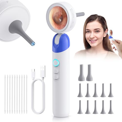 Otoscope Ear Camera with 1.38” Screen, 1080P HD Ear Scope with 4 LED Lights, Otoscope Camera for Adults Kids and Pets, 12 Silicone Specula Tips, Support Photo &amp; Video, Type-C Charging（Blue）