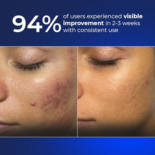 Image of Aqueria Hydrating & Brightening French Face Wash with Creamide Complex | Deep Cleansing, Non-Drying, Non-Stripping Gentle Cleanser for Dry to Normal, Sensitive Skin | Alpha Arbutin, Niacinamide, Fruit AHA BHA & Hyamagic-4D for Barrier Support & Even-Toned Skin | Reduces Pigmentation & Tanning | Dermatologist Validated, Fragrance Free, Gentle Foaming Formula |100ml