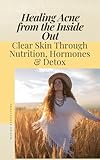 Healing Acne from the Inside Out: Clear Skin Through Nutrition, Hormones & Detox: A Holistic Guide to Balancing Your Body Naturally for Lasting Acne-Free Skin