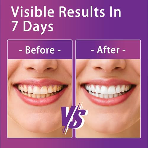 Image of Purple Teeth Whitening Strips 14 Treatments, Whitening Strips for Sensitive Teeth and Enamel Safe, Teeth Whitening Effectively Remove Stains (28 Strips)