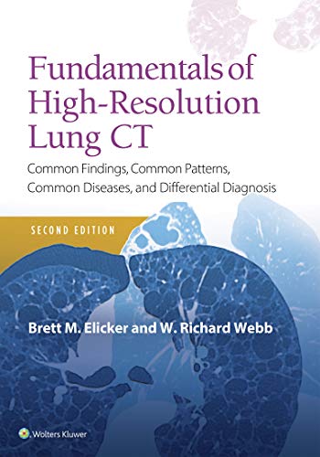 Fundamentals of High-Resolution Lung CT: Common Findings, Common Patterns, Common Diseases and Diffe Fundamentals of High-Resolution Lung CT: Common Findings, Common Patterns, Common Diseases and Diffe
