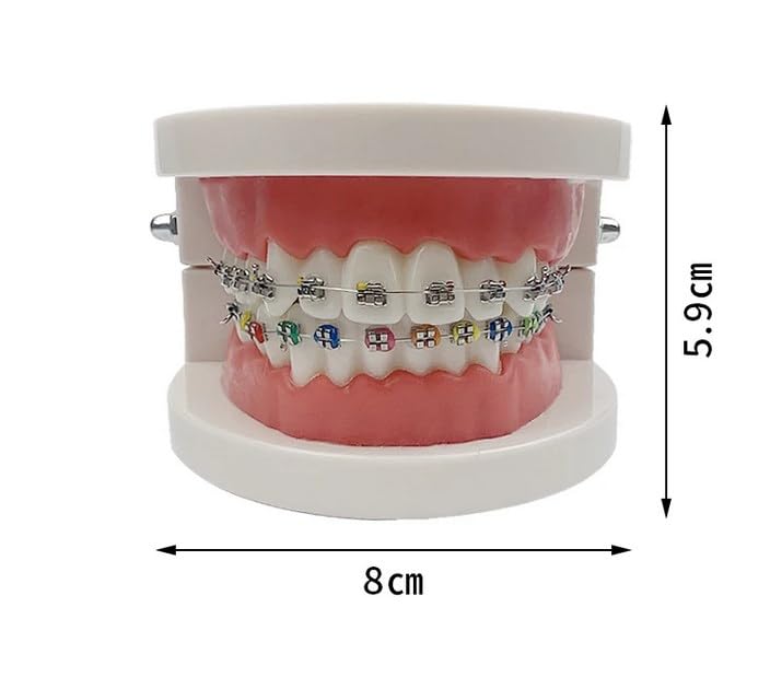 Modelo De Ortodoncia Y Herramienta De Dentista - Modelo De Dientes De Variedades Ortodoncia 60829 16