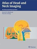 Atlas of Head and Neck Imaging: The Extracranial Head and Neck 1588901785 Book Cover
