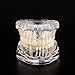 Ultrassist Transparent Disease Teeth Model with Dental Implant Bridge, Dental Model for Patient and Dental Student Education