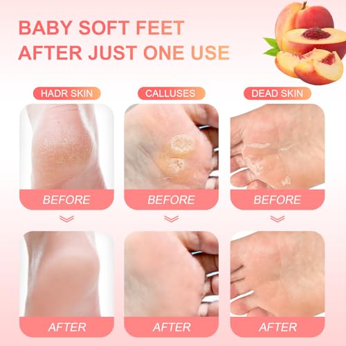 FUNNIR Foot Peeling Mask Exfoliant for Peeling Off Calluses, Natural Exfoliator for Dry Dead Skin, Callus, Repair Rough Heels Soft Smooth Touch — view 4