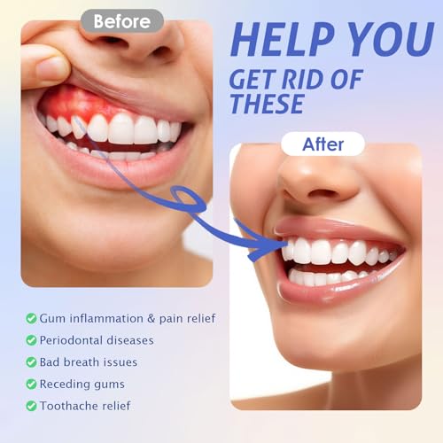 Red Light Therapy for Gums, Red & Blue LED Light Experience with 18 LEDs, Comfortable Silicone Mouthpiece, Portable Personal Oral Care for Gum Health Toothache Relief, Bleeding Gums Alternate view