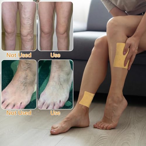 Image of Premium Varicose Veins Patches Dredge Vein Smoothing Varicose Veins Reduce Swelling Relieve Pain Instant Relief From Muscular Pain Improve Blood Circulation Skin Friendly (PACK OF 2 (24pcs))