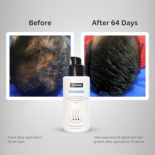 Image of Hair Growth Serum Salsphere Technology - 3% Redensyl, 3% Procapil, 3% Salsphere NHGP, 4% Anagain, 1% Hairiline - Significant Reduce Hair Fall & Stimulate Hair Growth | 50ml
