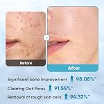 Elvira Glycolic Acid Exfoliating Facial Pads With 10% Glycolic Acid, 2% Salicylic Acid & Niacinamide - 60 Toner Pads, Daily Peel Treatment for Acne Prone Sensitive Skin - Image 3