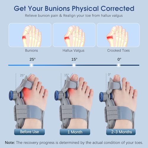 Image of KASHEVI Bunion Corrector for Women & Men Big Toe: Adjustable Bunion Fix for Big Toe Separation Pain Relief - Orthopedic Bunion Splint with Straightener for Toes Alignment Hallux Valgus Correction