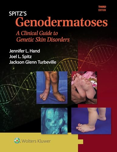  Spitz\'s Genodermatoses: A Full Color Clinical Guide to Genetic Skin Disorders