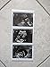 Prank 2D Customized Fake Ultrasound Strip of 3 Photos