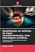 Reabilitação de defeitos de hemi-mandibulectomia: Uma abordagem protética 6209254799 Book Cover