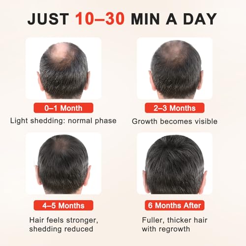 Image of Red Light Hair Growth Cap, 528 Total Light Emitters, Red Light Therapy for Hair,At-Home Scalp Care for Men & Women,Gift Idea,Adjustable Comfort Disgn,Black Cap
