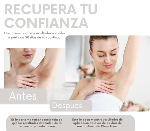 Tratamientos, Luxury Beauty glicolic crema las manchas Marca Sin Dolor (2)