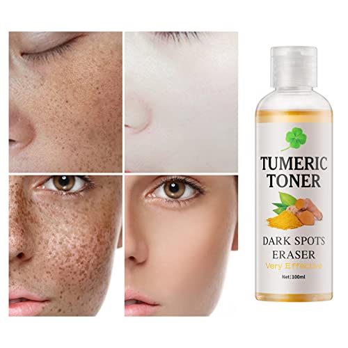 Toner For Dark Spots Turmeric Dark Spot Corrector Toner, Facial Toner For Acne Prone Skin, Dark Spot Remover For Face Hydrating Face Toner For Women, Hyperpigmentation Treatment For Dry Oily Skin 4Oz #TOP2