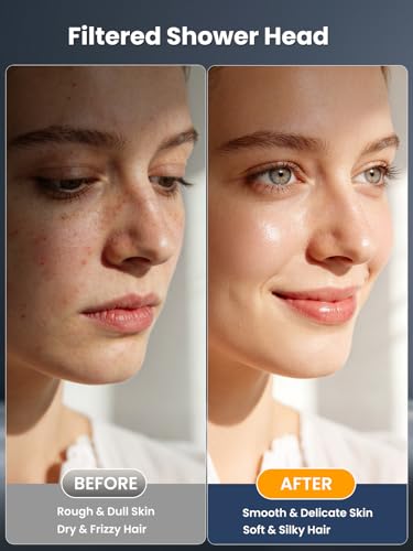 Yeaupe Pro Soffione Doccia Con Filtro A 25 Fasi, Alta Pressione Ø110Mm Con Filtro, Con 6 Tipi Di Getti, Soffione Doccia Anticalcare Cromato Con 2 Filtri Di Ricambio, Benessere E Comfort, Cromato - 4