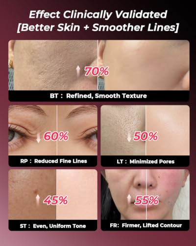 Microcurrent Facial Device - 5-in-1 Skin Tightening & Lifting Facial Machine - 5 Color Face Light Therapy Device - Professional Skin Care Tone Beauty Devices for Face, Neck, and Eye Area - Image 6