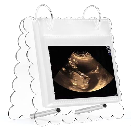 Flip Ultrasound Photo Album with Stand, Refillable Flip-Through Display for 3x4 Pictures, Acrylic Scalloped Cover, Pregnancy Gift for New Parents (Small)