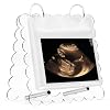 Flip Ultrasound Photo Album with Stand, Refillable Flip-Through Display for 3×4 Pictures, Acrylic Scalloped Cover, Pregnancy Gift for New Parents (Small)