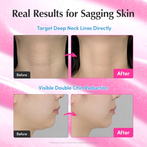 image for EQQUALBERRY NAD+ Peptide Boosting Serum | 14 Peptide Serum for Face, N